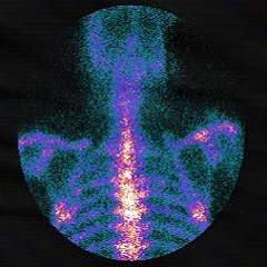 Printing interface for gamma camera